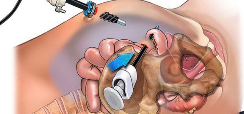 bbc-anestesia-4.jpg