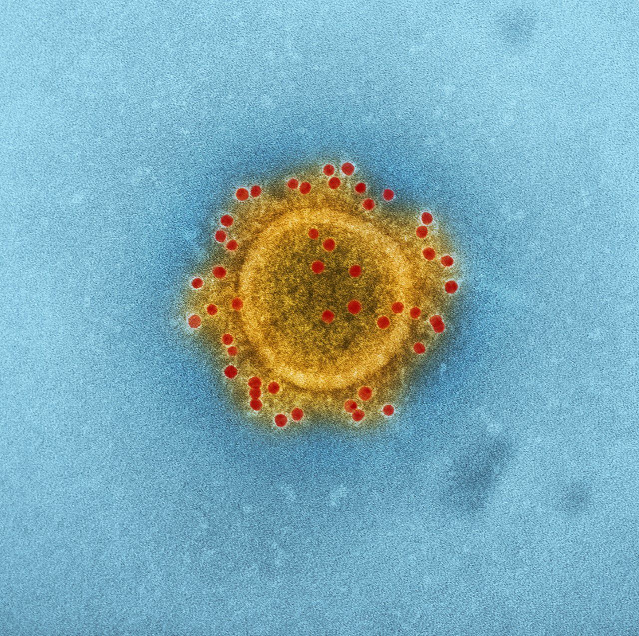 COronavirus al microscopio CDC