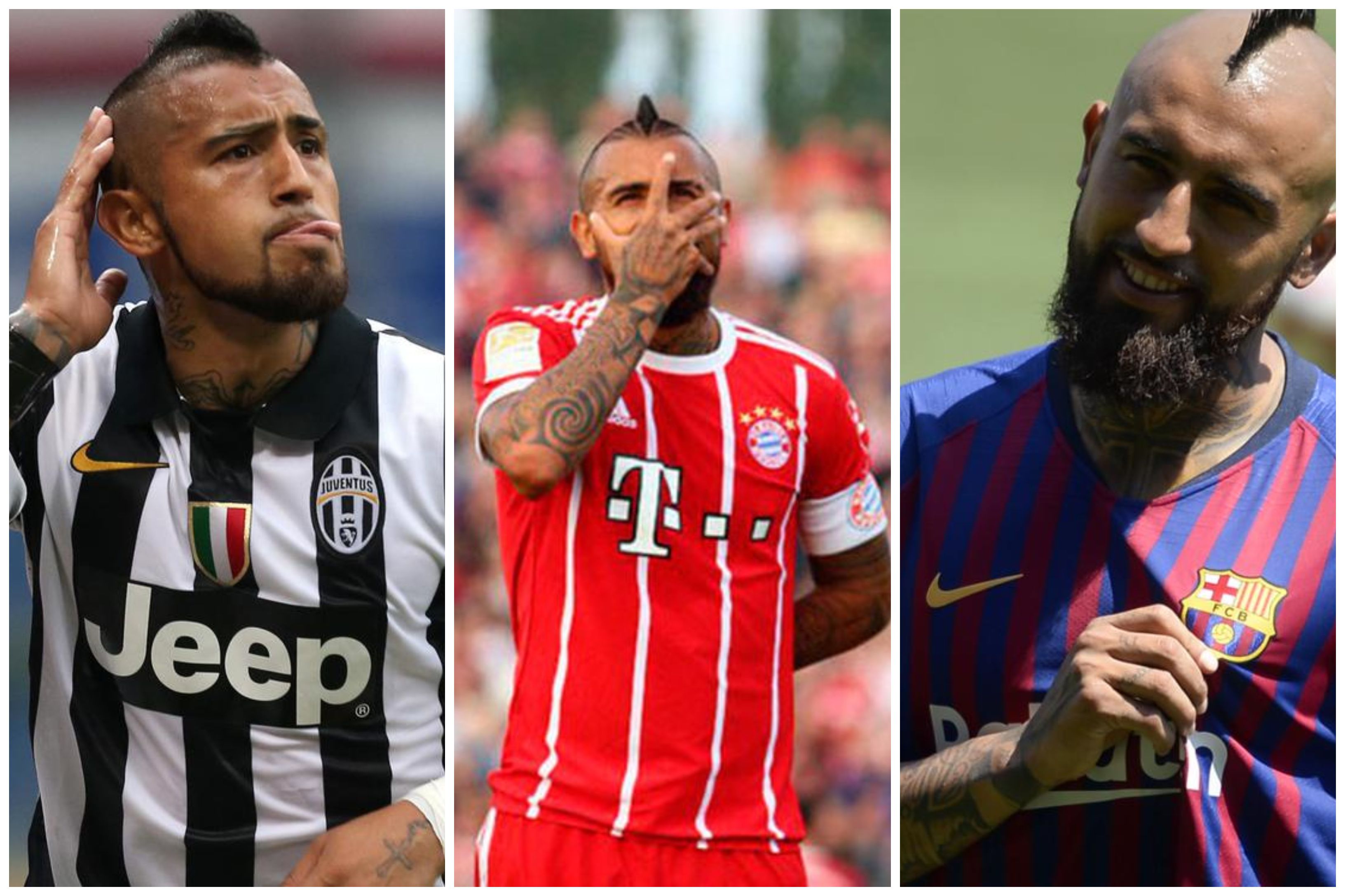 Arturo Vidal: Juventus, Bayern Múnich y Barcelona