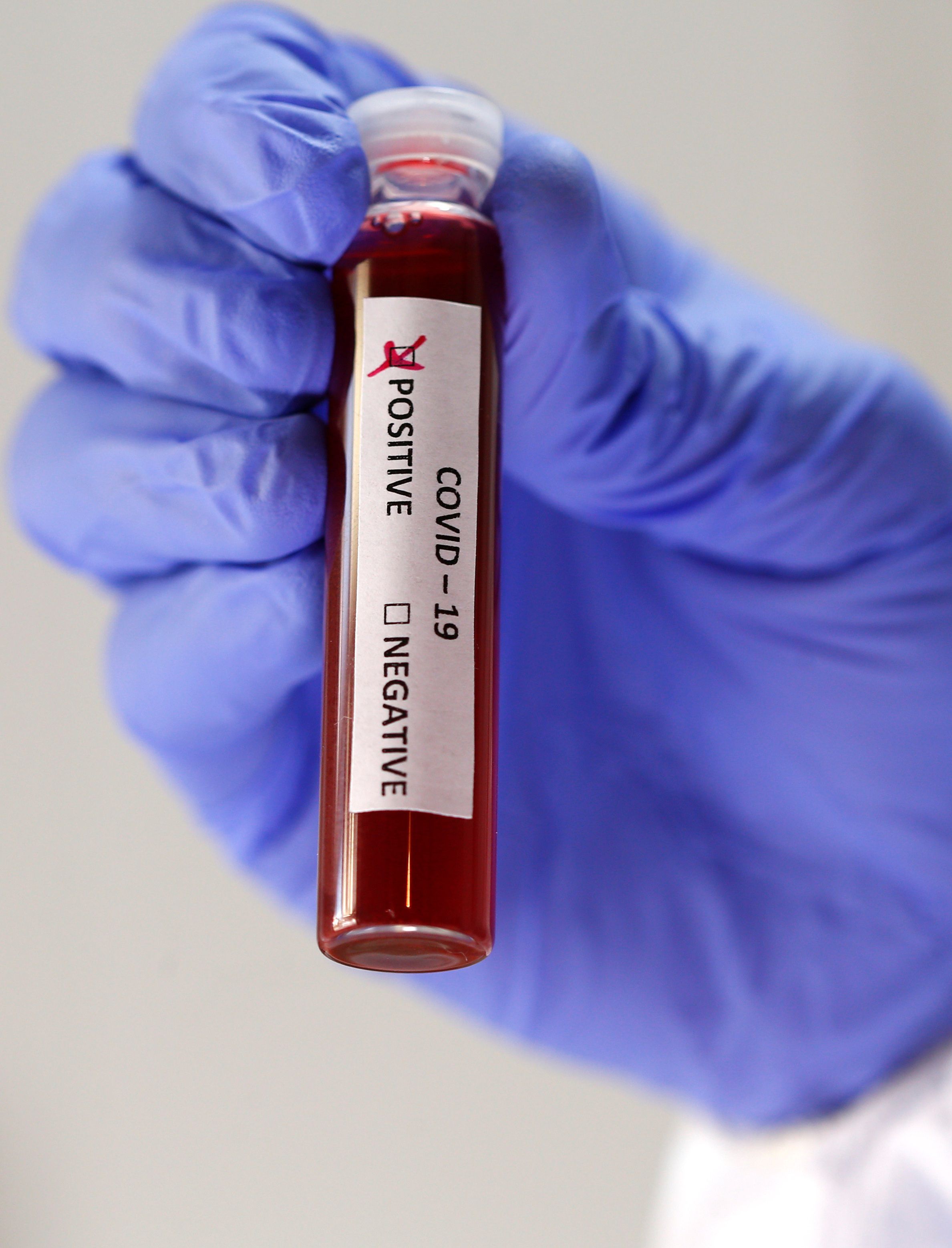 Fake blood is seen in test tubes labelled with the coronavirus (COVID-19) in this illustration