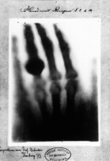 First_medical_X-ray_by_Wilhelm_Röntgen_of_his_wife_Anna_Bertha_Ludwigs_hand_-_18951222.gif