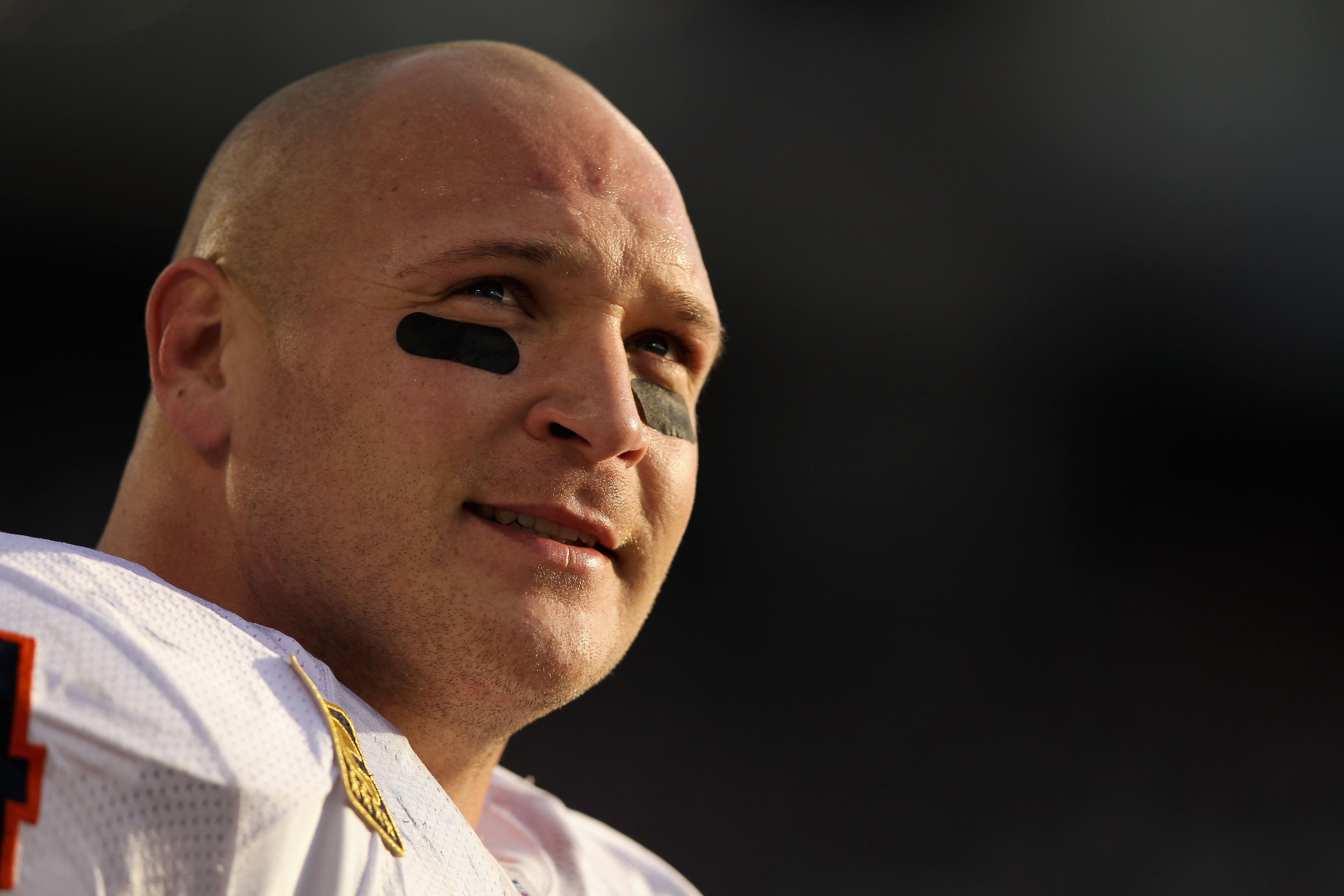 Ex Chicago Bears star Brian Urlacher no longer bald