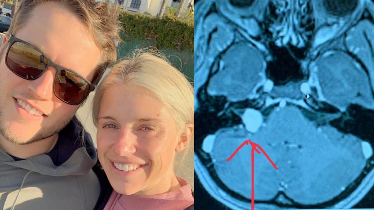 Kelly Stafford, wife of Lions QB, having brain surgery to remove tumor