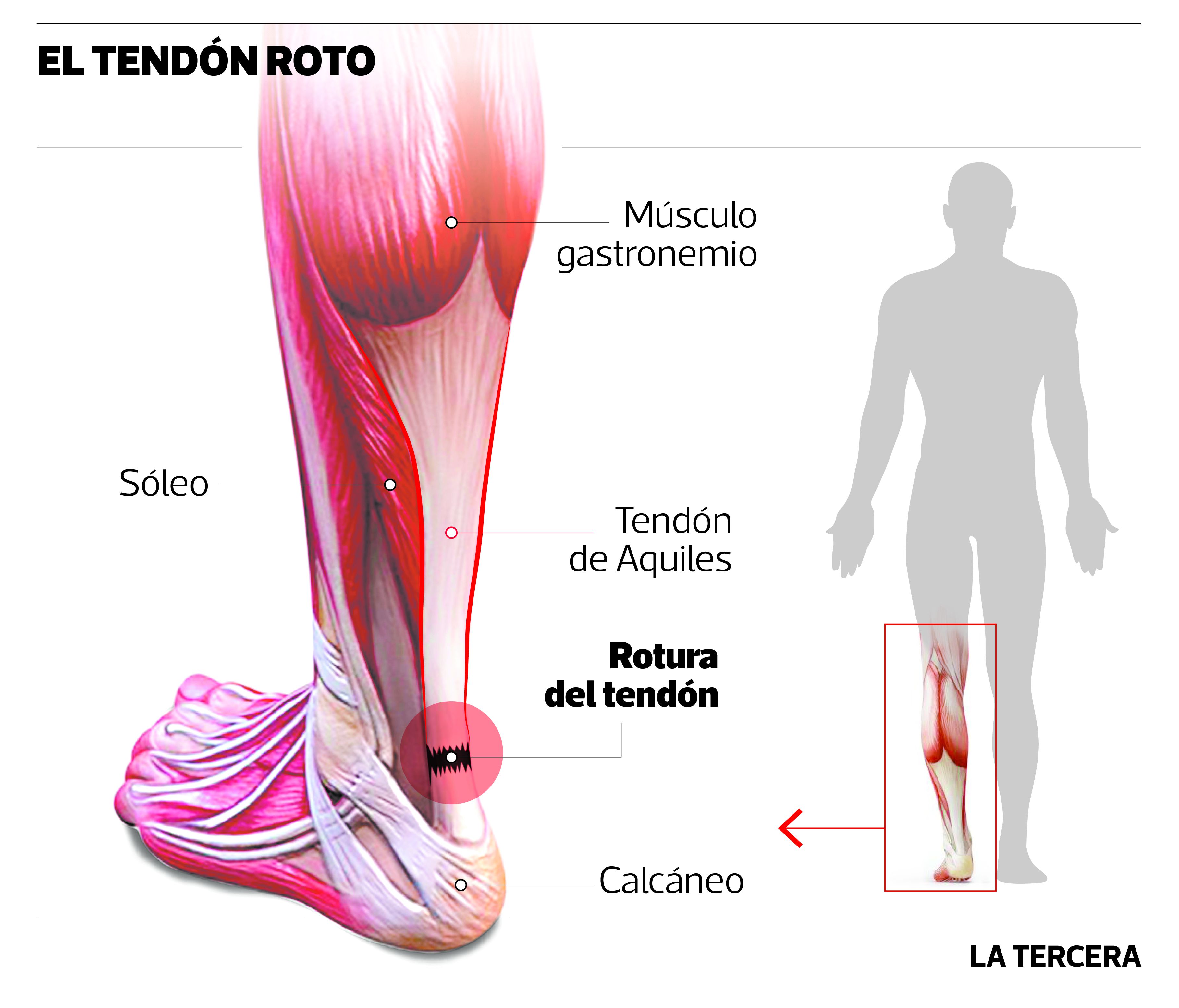 DEP-Lesion-Bravo-01.jpg