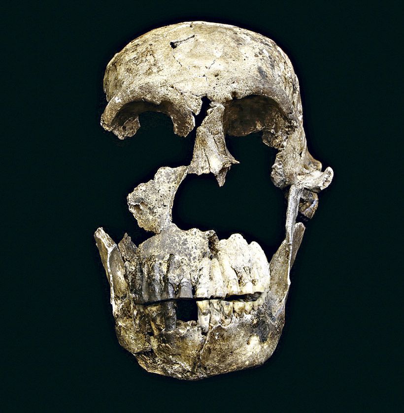 Imagen-6.neo-skull-frontal-view.jpg