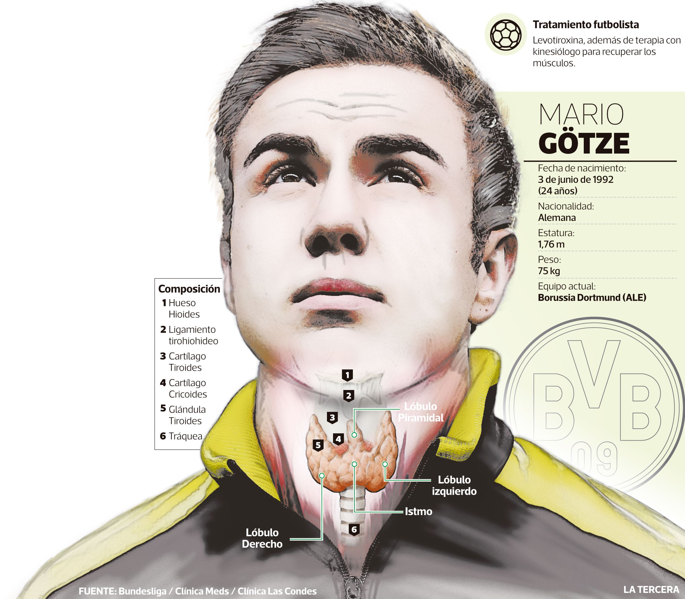 Gotze infografía