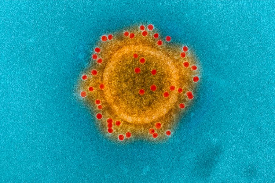 coronavirus5