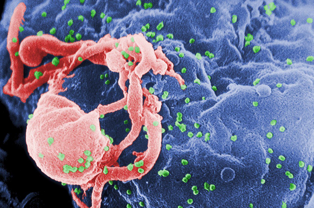 1280px-HIV-budding-Color.jpg