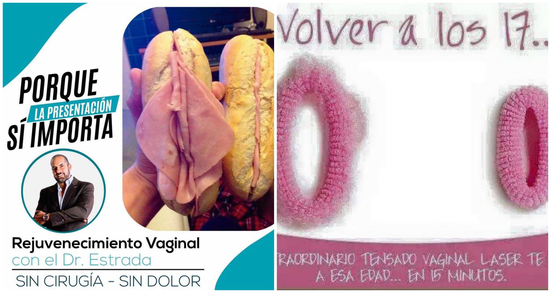 Explotando el deseo de vaginas perfectas | EL ESPECTADOR