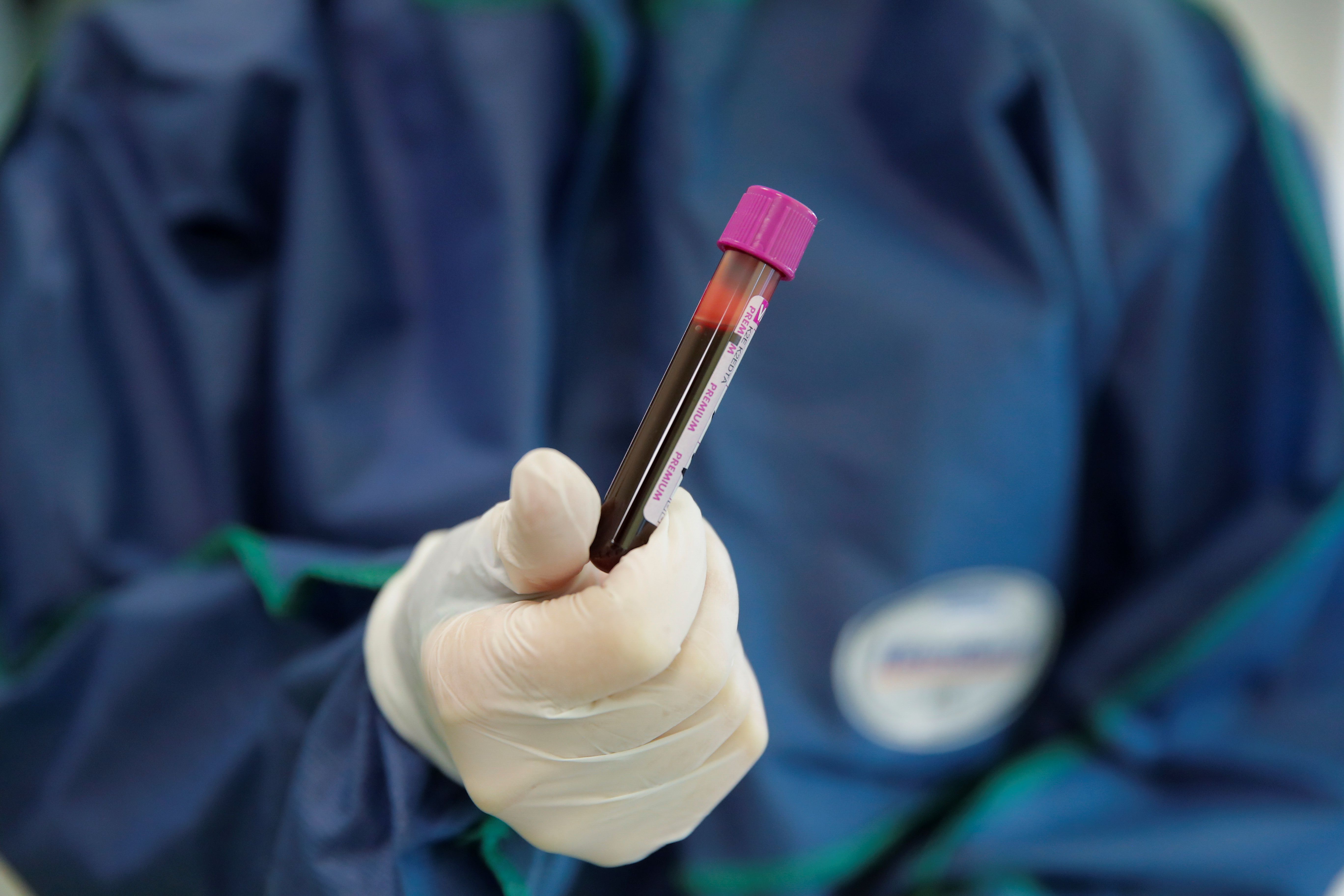 A medical specialist holds a testing tube with blood in a clinic offering tests for for antibodies against the coronavirus disease (COVID-19) in Moscow A medical specialist holds a testing tube with blood in Hadassah clinic, which offers tests for for antibodies against the coronavirus disease (COVID-19), at the Skolkovo innovation centre on the outskirts of Moscow, Russia April 24, 2020. REUTERS/Maxim Shemetov