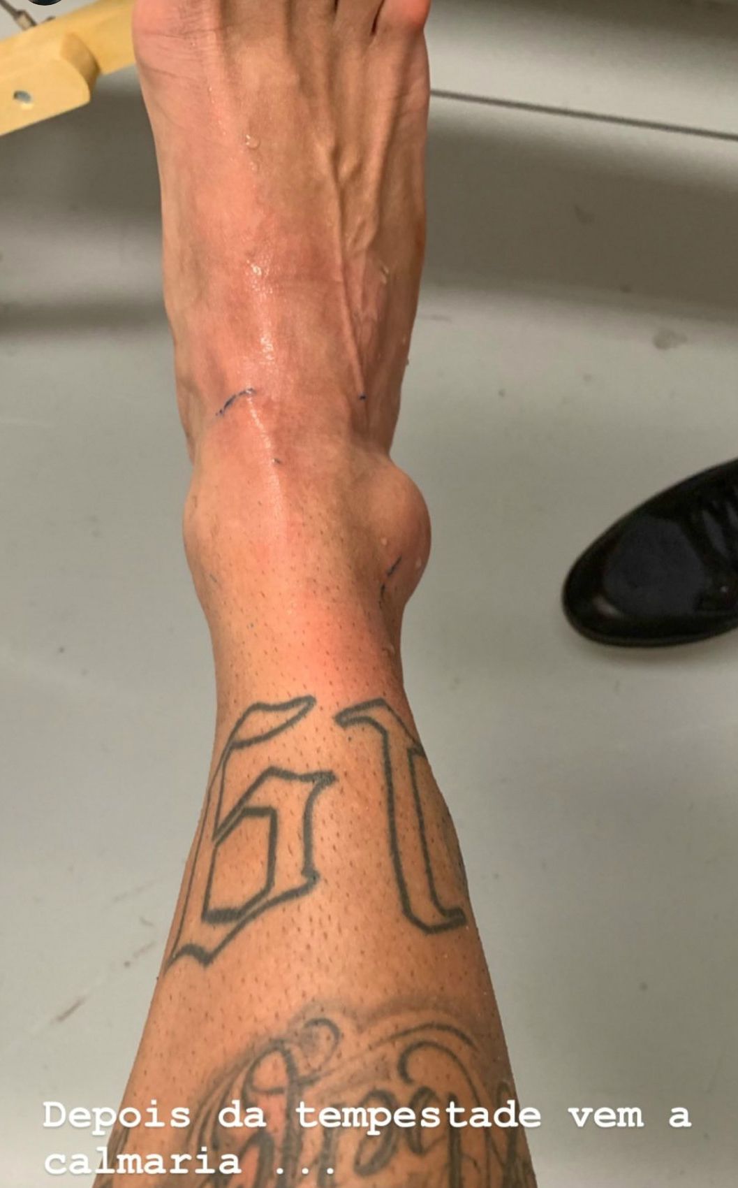 NEYMAR-LESION.jpg