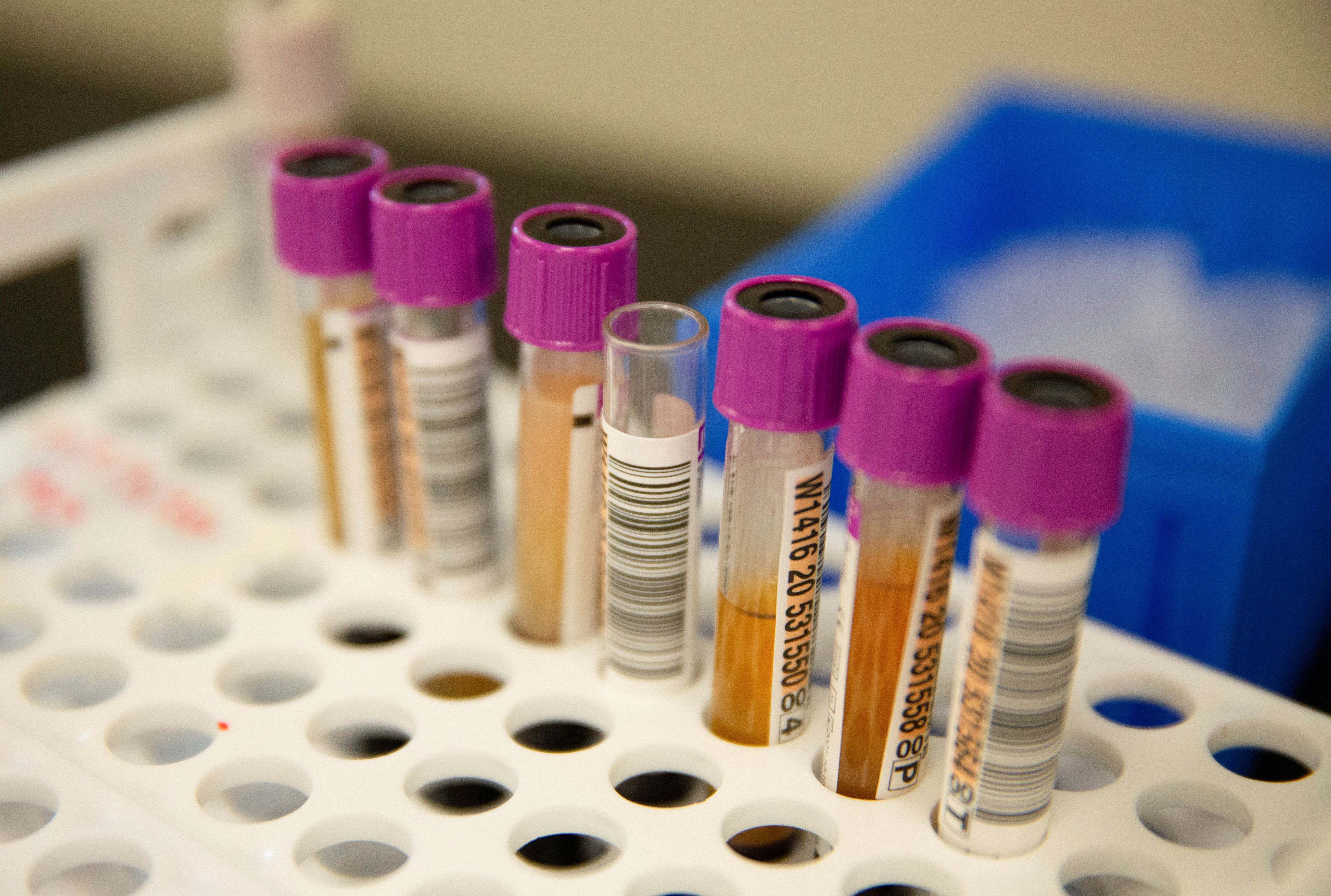 FILE PHOTO: Plasma samples at Bloodworks in Renton