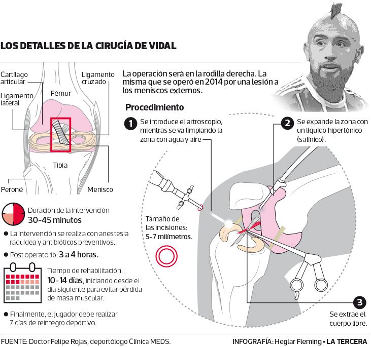 DEP-rodilla-de-vidal.jpg