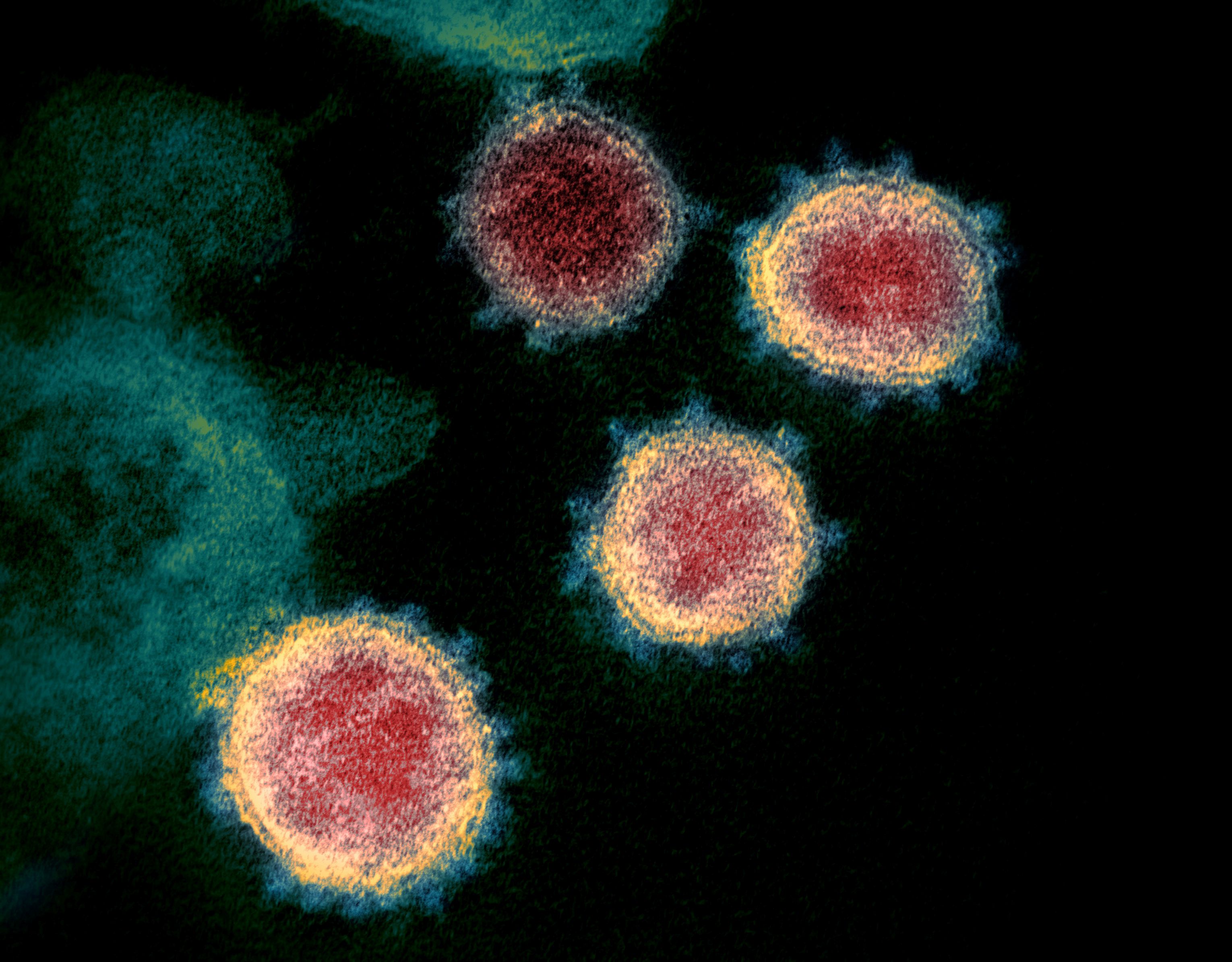 FILE PHOTO: Transmission electron microscope image shows SARS-CoV-2, also known as novel coronavirus