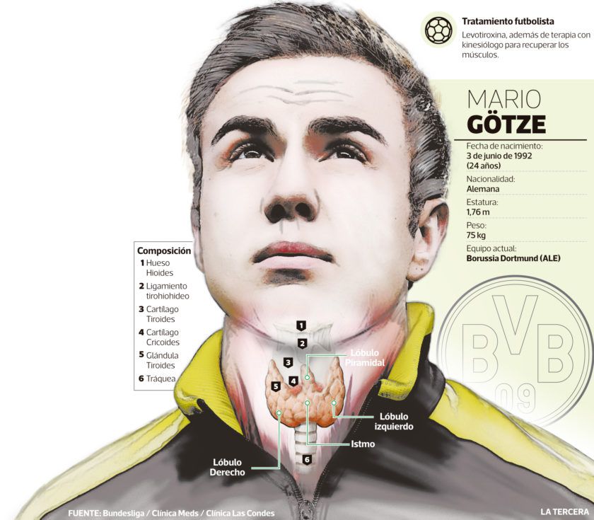 gotze-2-840x735.jpg