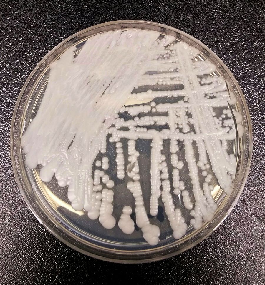 A-strain-of-Candida-au-664330.jpg