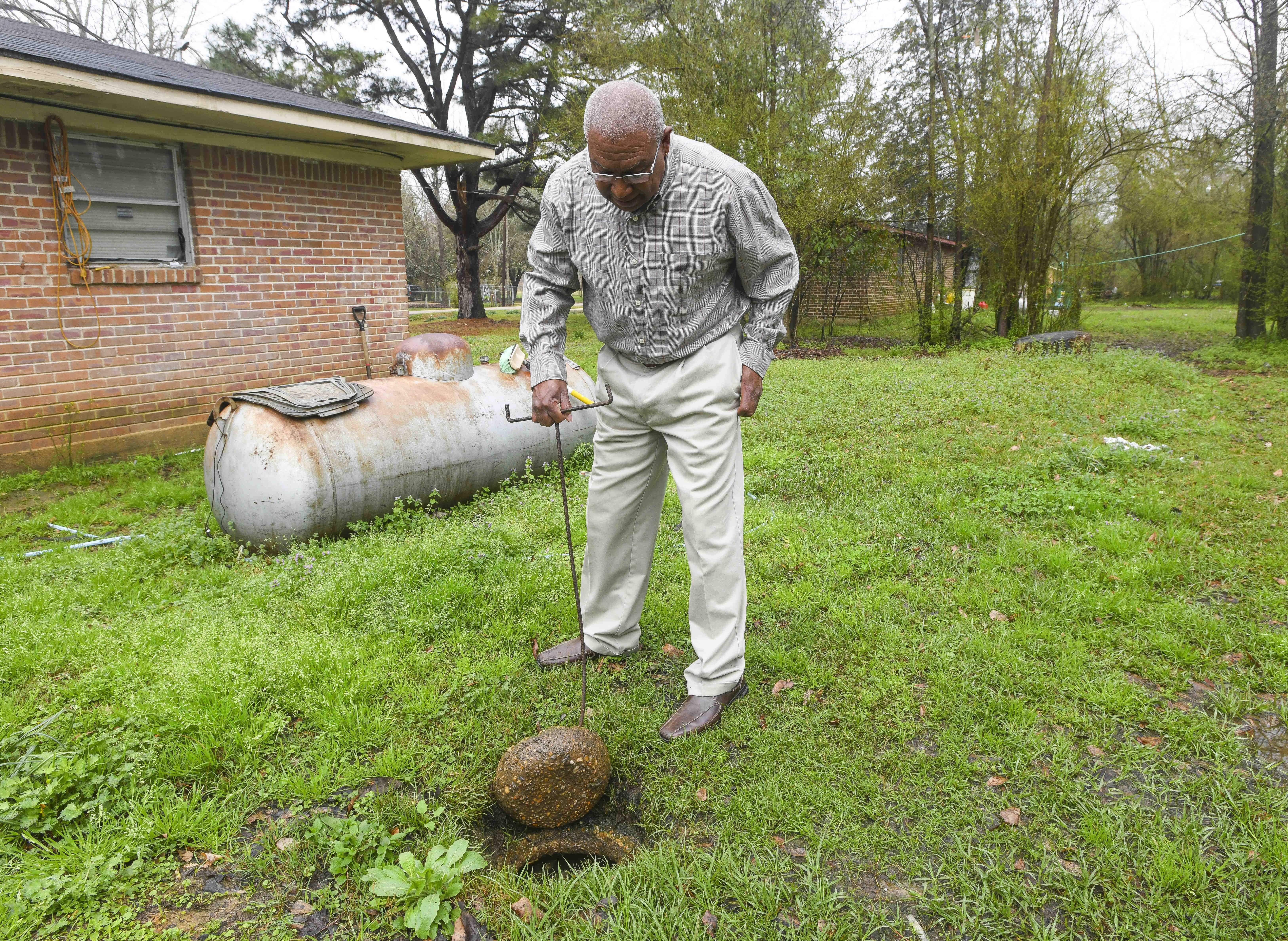 Fighting Hookworm In Alabama: Easier And Harder Than In Low Resource  Countries : Goats and Soda : NPR