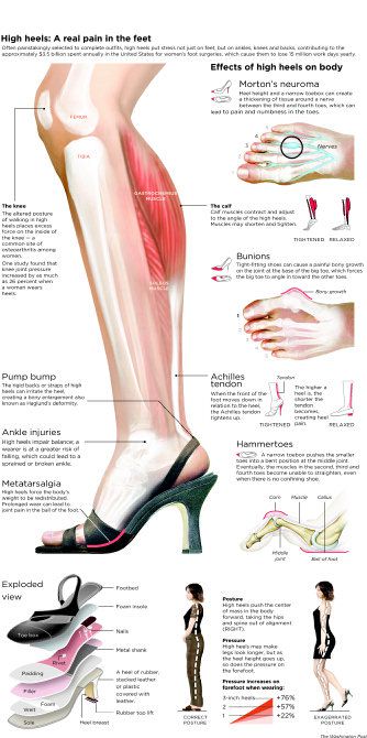 How Wearing High Heels Causes Pain