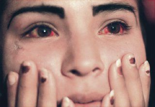El mal de ojos rojos y legañas