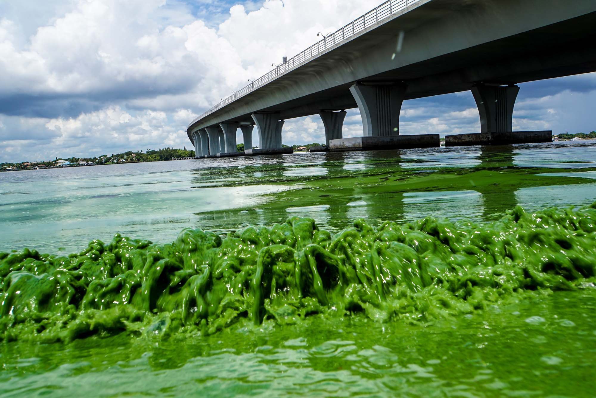 Five things to know about blue-green algae. (Yeah, it's bad. And it's  getting worse.)